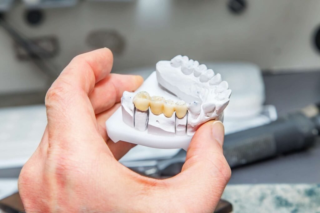 dental bridge on model of mouth