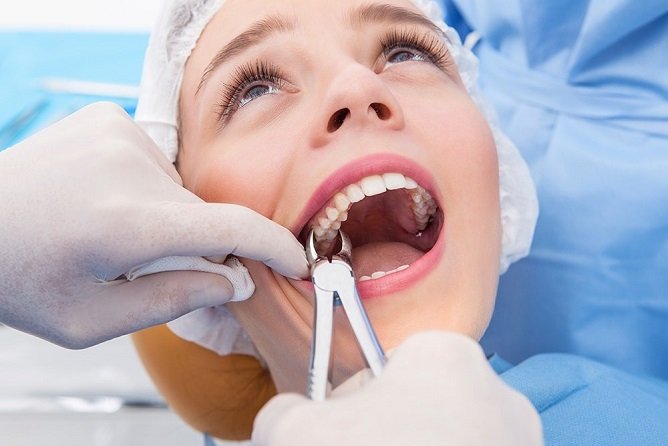 person having tooth extracted