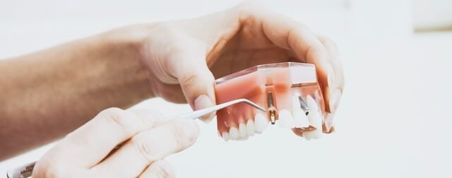 dentist showing dental implant