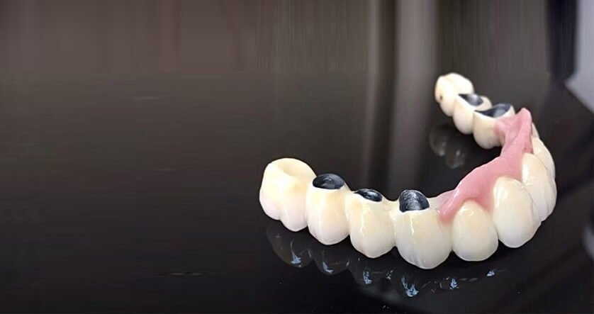 partial dentures on table